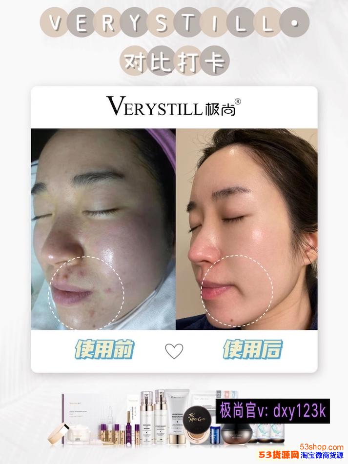需提升!濠江论坛澳门资料2025-管家婆一肖一码免费资料_真正的效果如何;影响深远的决策、值得解释落实